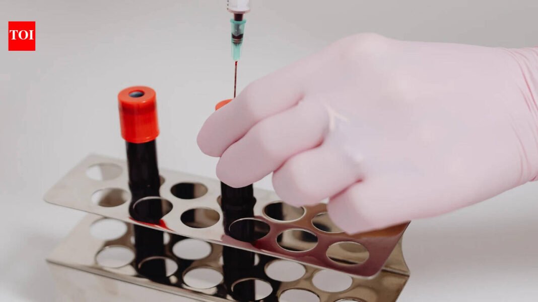 Government recommends abandoning repeated virus testing for plasma drugs