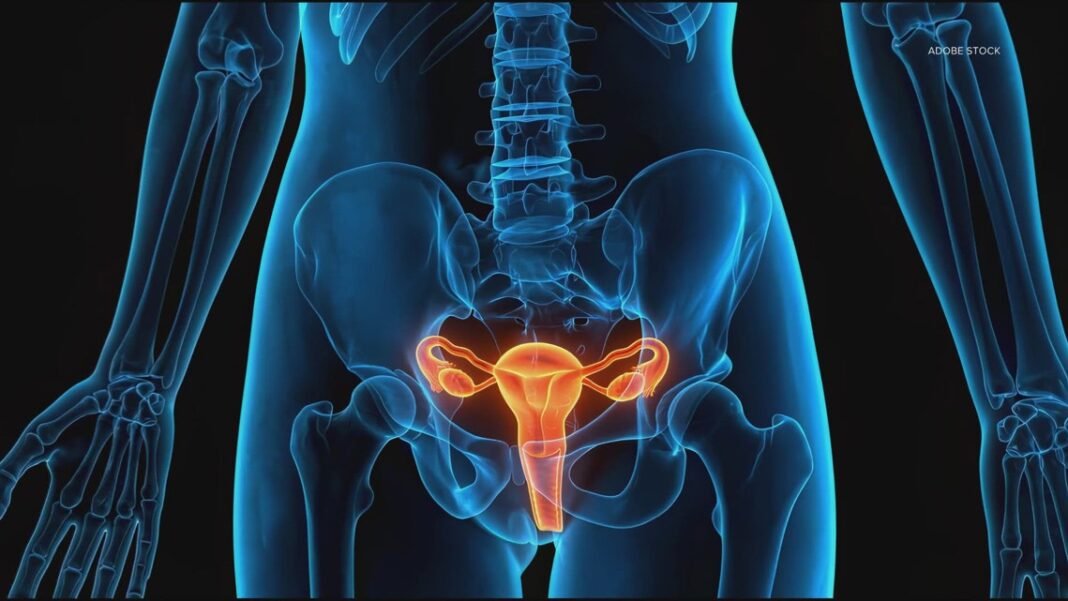 A hormonal imbalance that affects millions of women has a new name. Here’s Why It’s Important: HealthLink