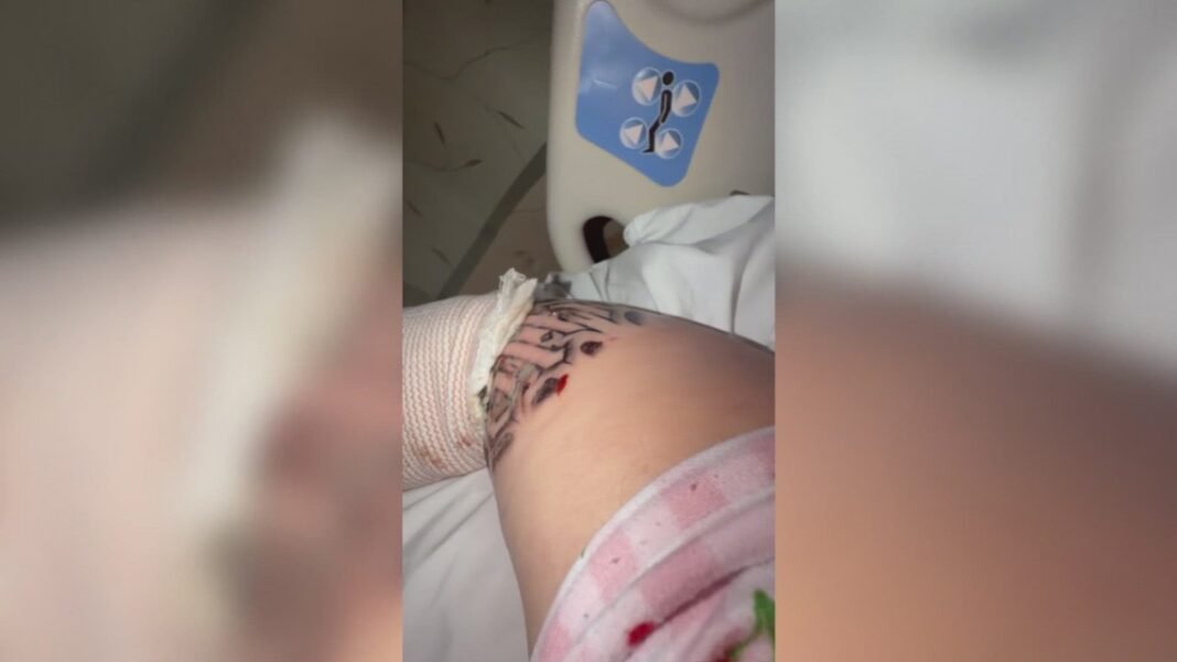 Arizona woman hospitalized after serious complications from tattoo
