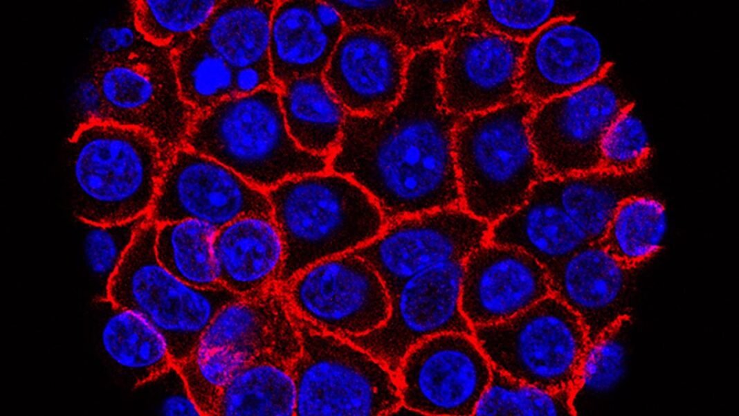 New drug nearly doubles survival time for pancreatic cancer patients