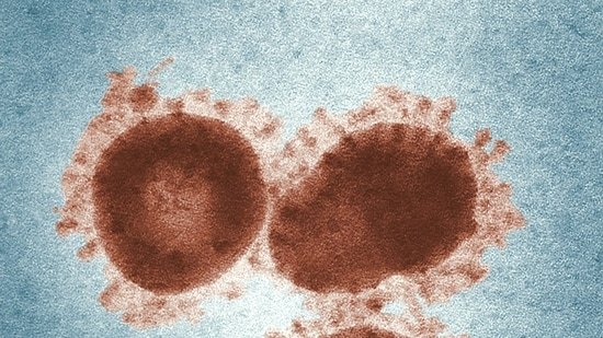 What is the “vomiting disease” spreading across America? Everything you need to know about the highly contagious stomach virus