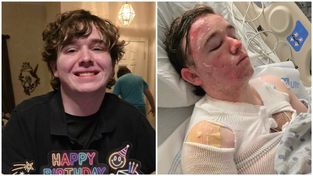 A 20-year-old McDonald’s employee in California was severely burned after a co-worker poured hot oil on him