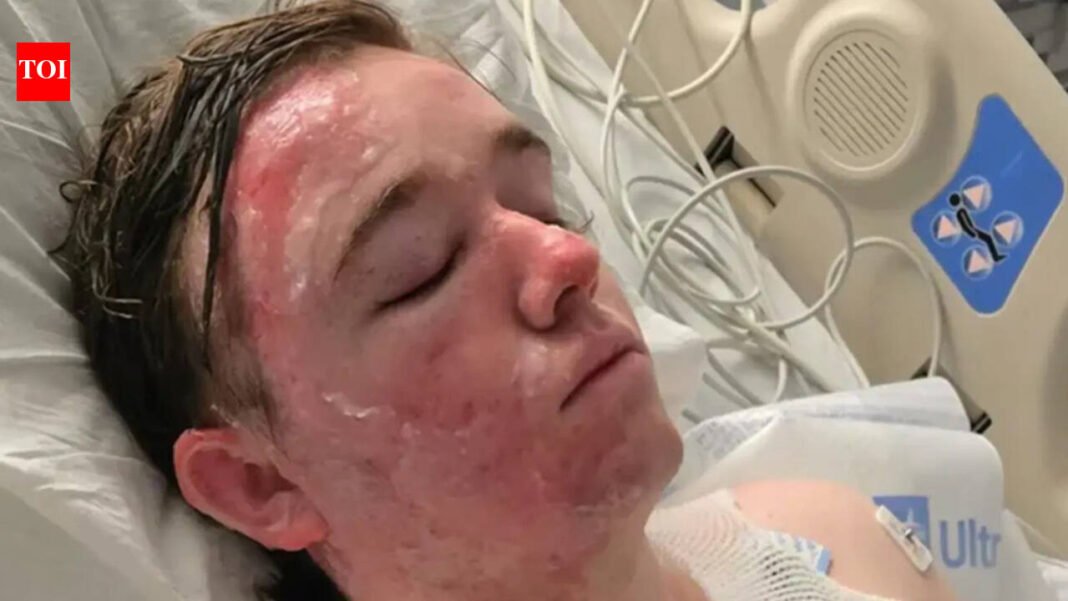 McDonald’s worker left intensive care after colleague poured scalding oil on him, mother launches fundraiser: ‘The pain he’s going through…’
