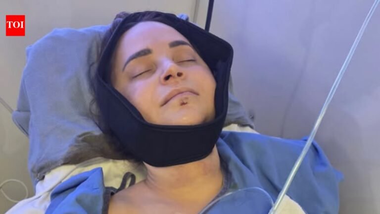 Rosanna Pansino Surgery: YouTuber Rosanna Pansino undergoes surgery after breaking jaw in boating accident